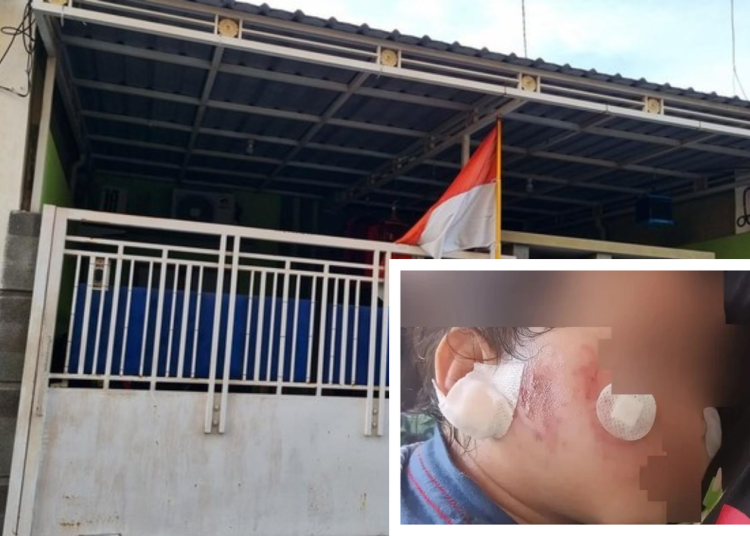 Tertipu Ulasan Google, Orang Tua Menyesal Anaknya Luka Usai Disewa Daycare Little Aresha Jogja