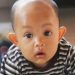 Anak di Lingga Terluka Akibat Kebakaran, Dirujuk ke Batam dan Tak Bisa Berjalan Lagi